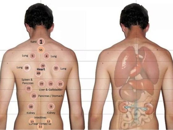 Pourquoi faire une Hijama