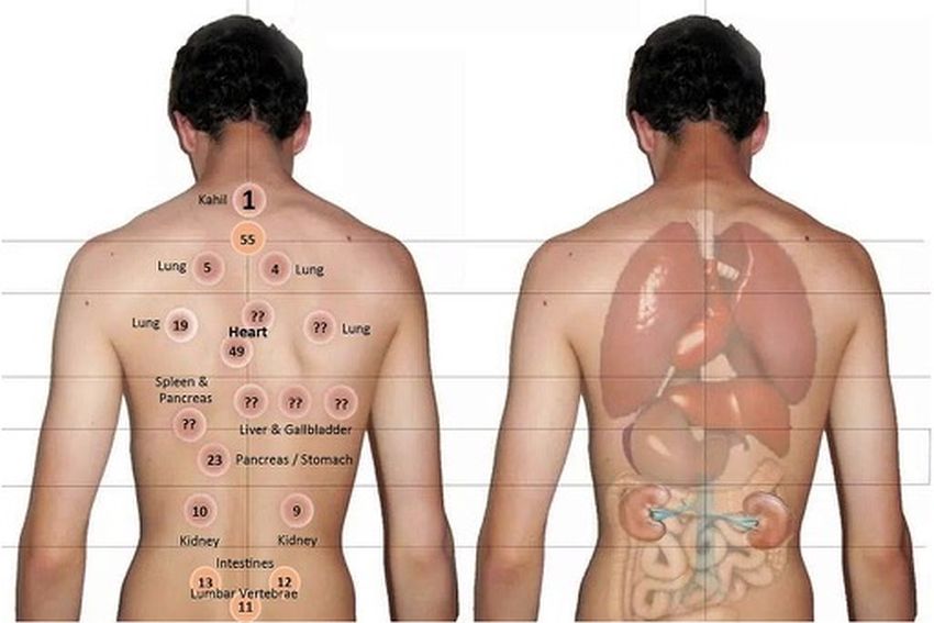 Pourquoi faire une Hijama