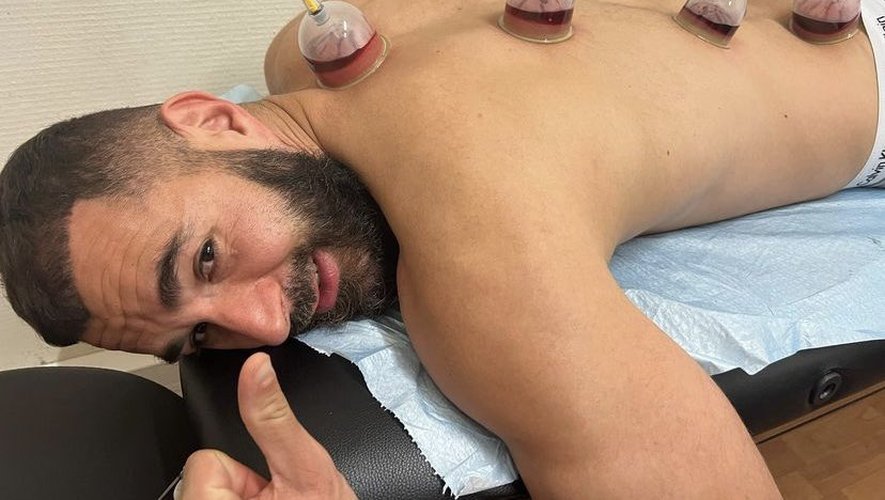 Sang Noir en Hijama