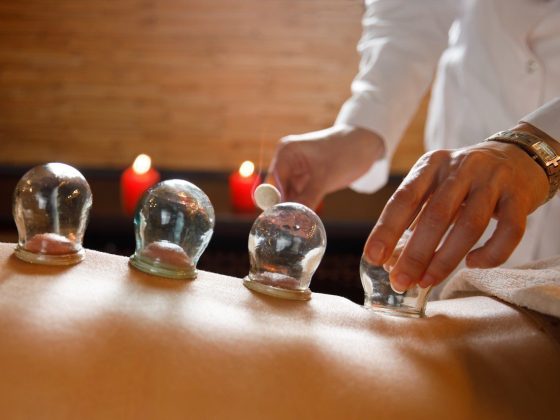 Les Bienfaits de la Hijama : Une Pratique Ancestrale au Service de la Santé Moderne