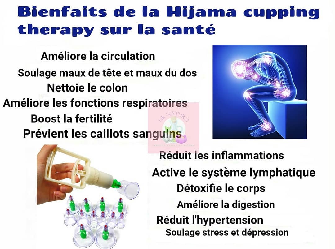 Bienfaits de la Hijama Cupping Therapy