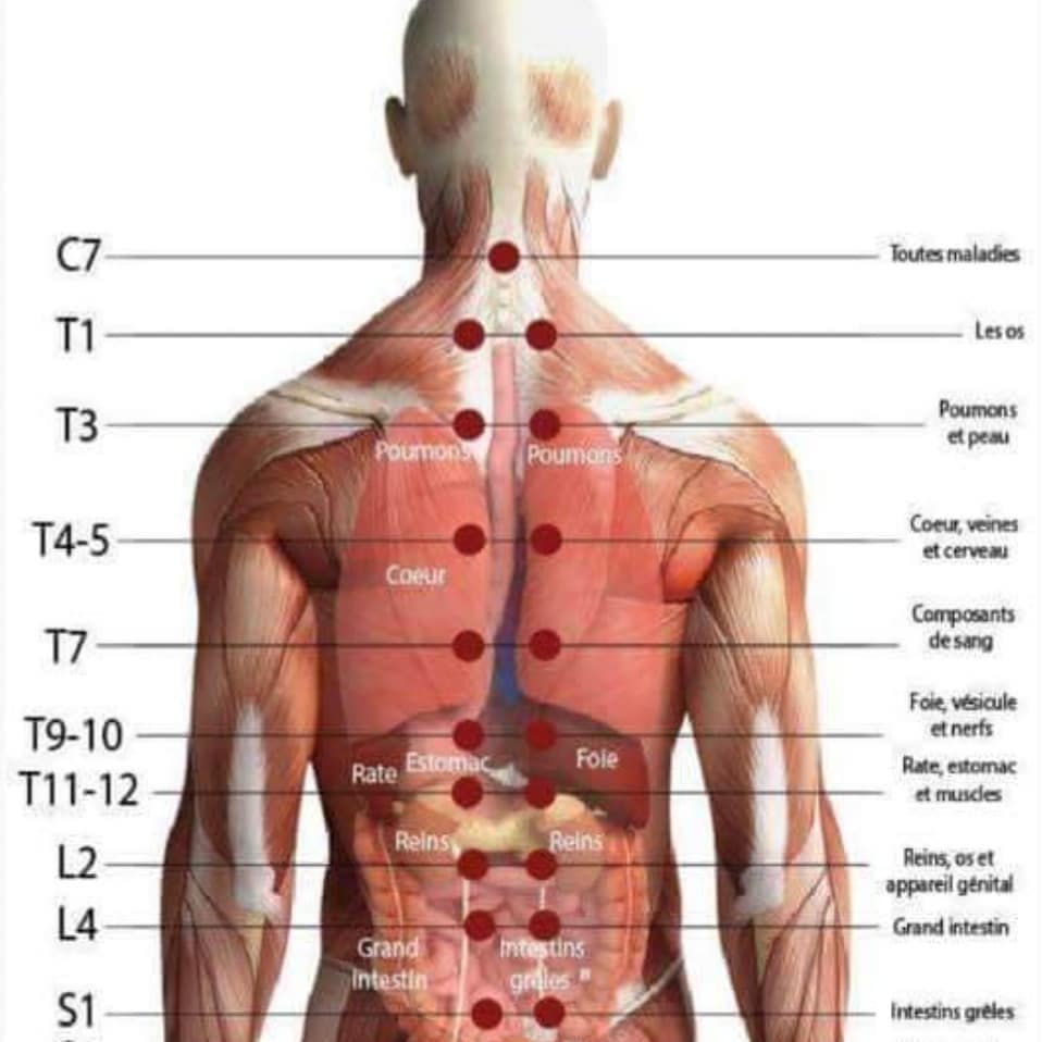 Pourquoi la Hijama dans le Dos