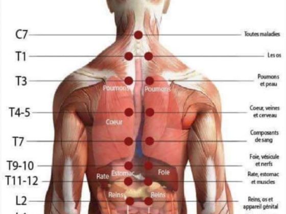 Hijama dans le Dos