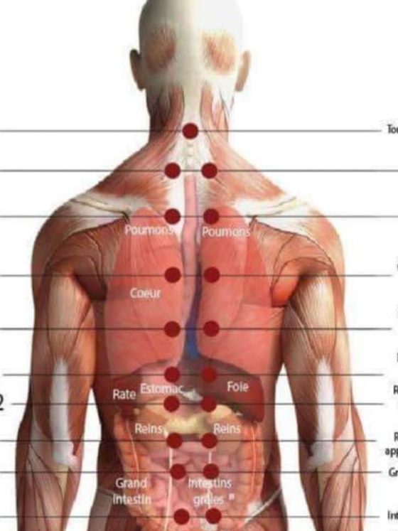 Hijama dans le Dos