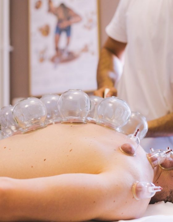 La Hijama